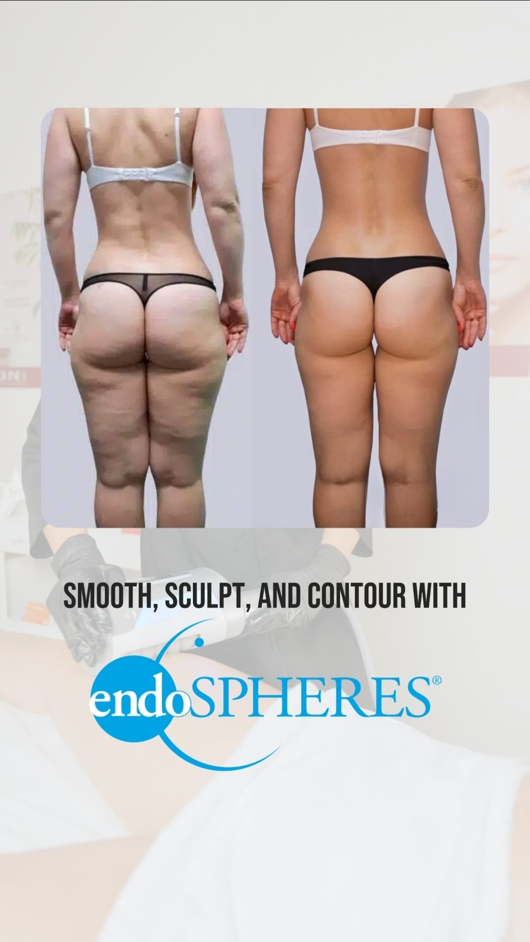 Endosphere Animation Affect