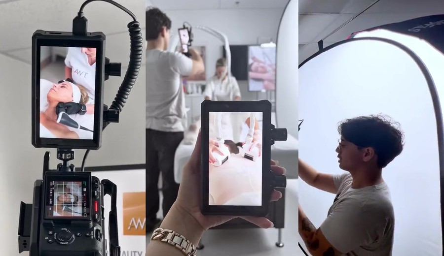 Social Medispa cameras, monitors and crew filming a med spa treatment on location