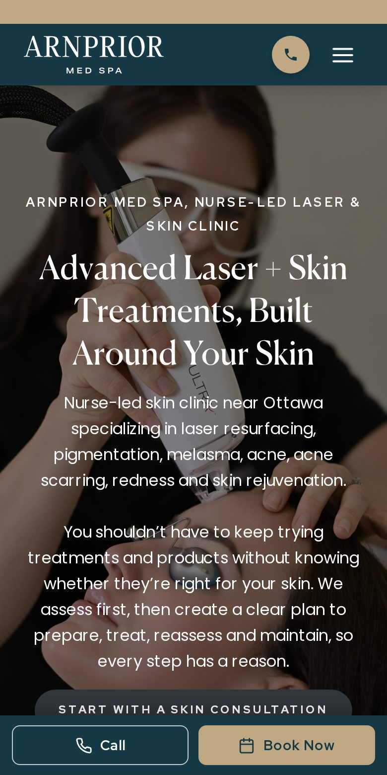 Arnprior Med Spa home page on a phone